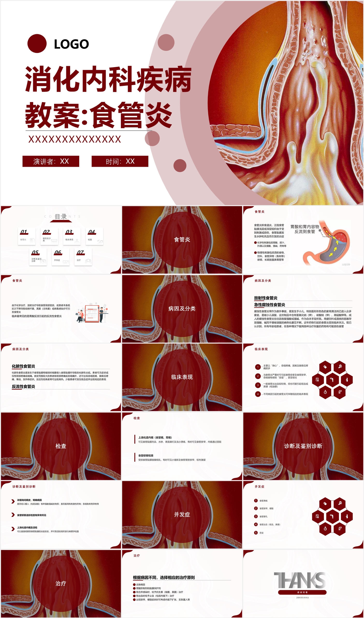 反流性食管炎模型-【动物造模】|反流性食管炎|十二指肠|食管|韧带|细胞炎症|-健康界